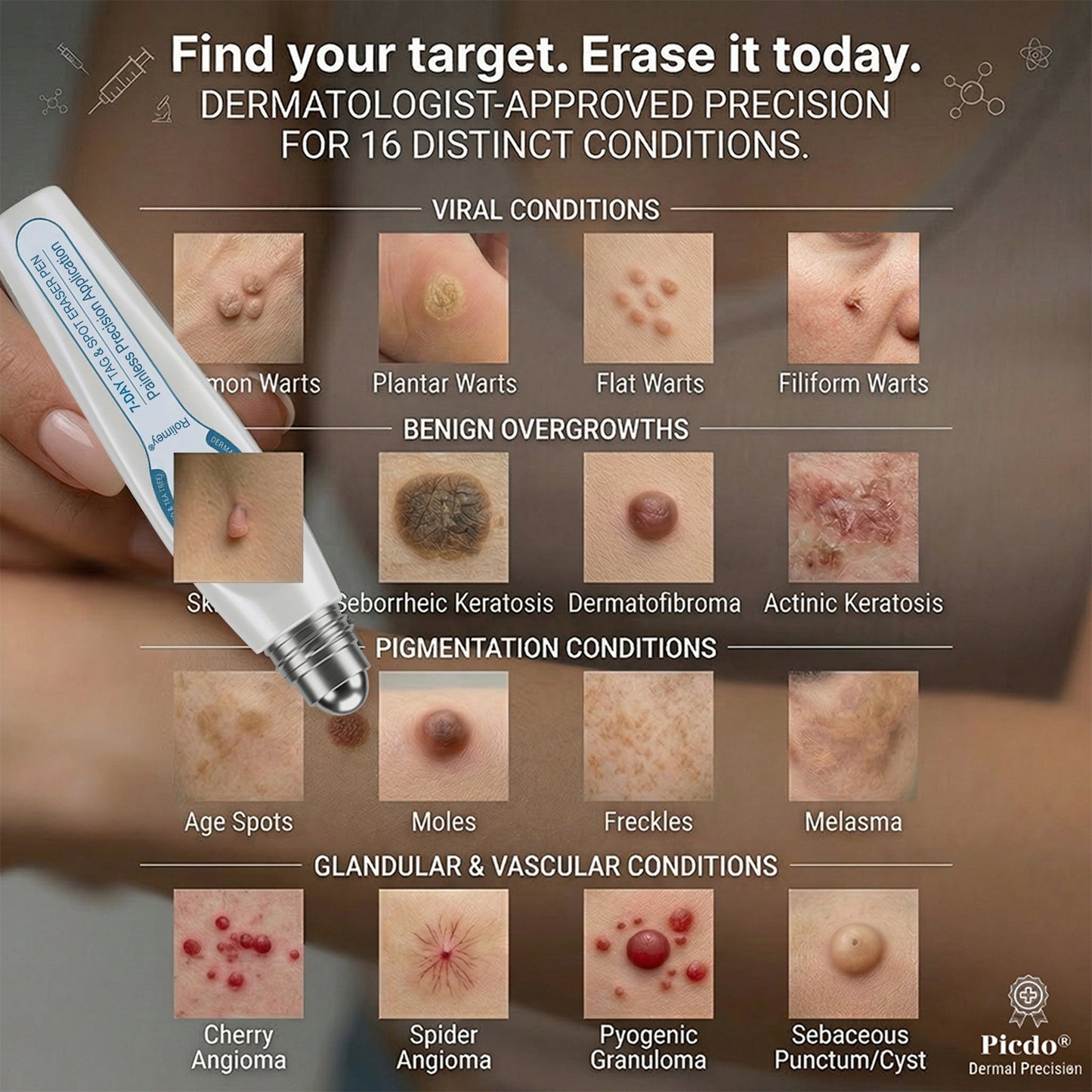 💕Official Brand Shop | Rolimey® 7-Day Roll-On for Skin Spots and Skin Tags – Pain-Free & Scar-Free