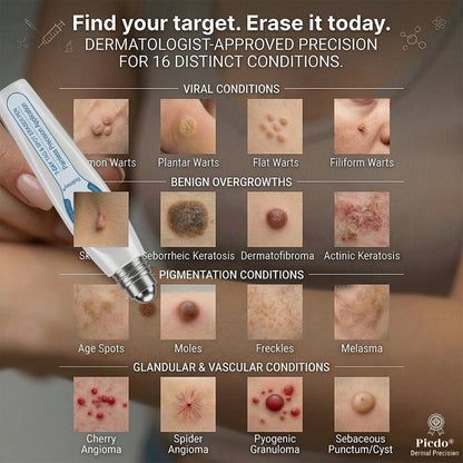 ❤️Official Brand Shop | Rolimey® 7-Day Roll-On for Skin Spots and Skin Tags – Pain-Free & Scar-Free