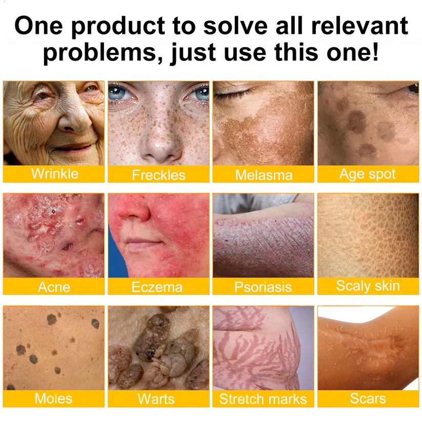 🌟❤️ Rolimey® Bee venom Pro Comprehensive Cream —Tightening for Skin Types 🔥