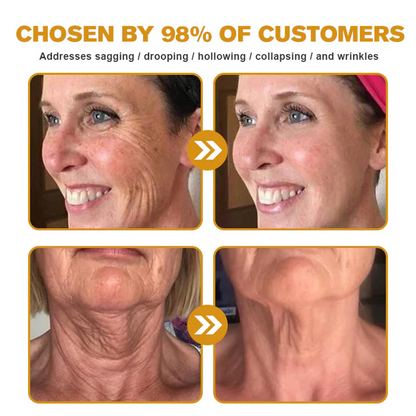 🌟❤️ Rolimey® Bee venom Pro Comprehensive Cream —Tightening for Skin Types 🔥