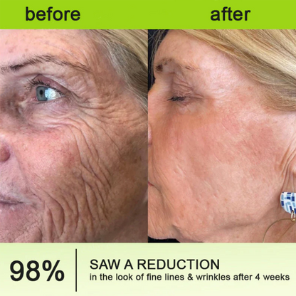 Add Hyaluronic Acid Serum — Save 30% Today