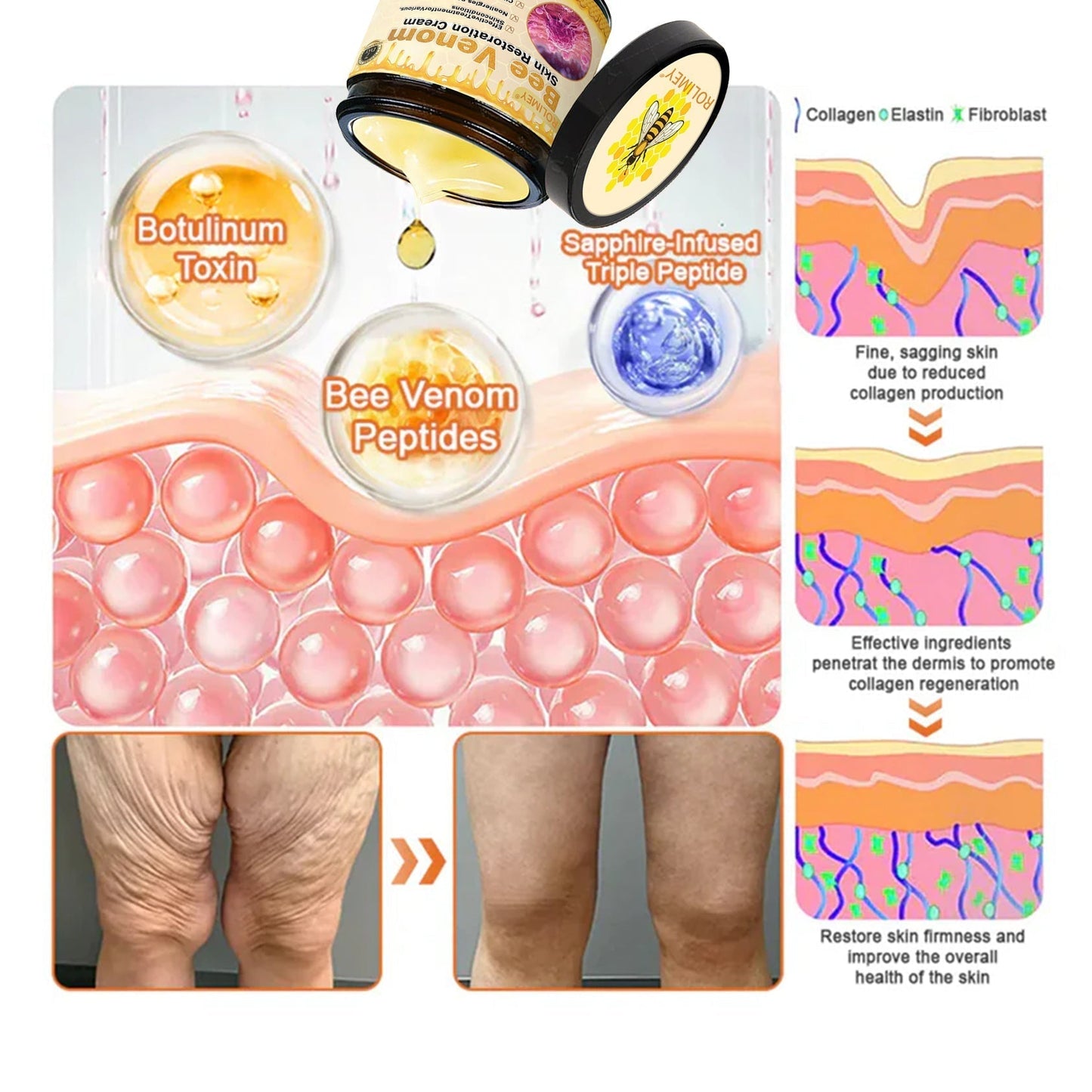 🌟💛 Rolimey® Bee venom Pro Comprehensive Cream —Tightening for Skin Types 🔥