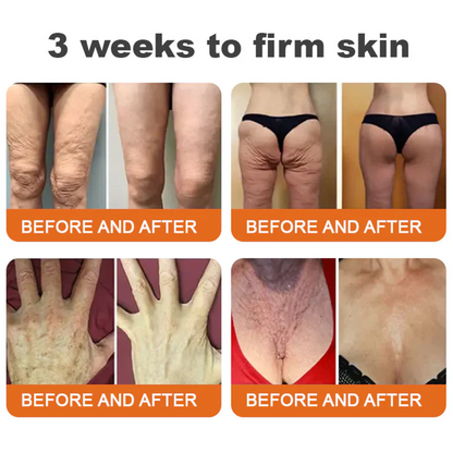 🌟❤️ Rolimey® Bee venom Pro Comprehensive Cream —Tightening for Skin Types 🔥
