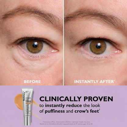 🎁Final 3 Hours: 70%OFF Instant Eye Tightener Easy-Wear Formula With Brush Free!