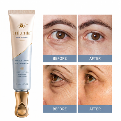 Trilumia SKIN SCIENCE PEPTIDE LIFTING EYE TREATMENT TARGETS PUFFINESS